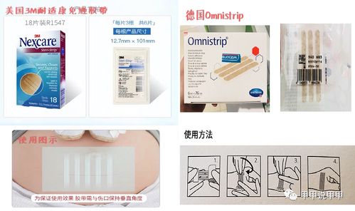 術(shù)后祛疤減張產(chǎn)品 減張器與減張貼相關(guān)問題匯總解答